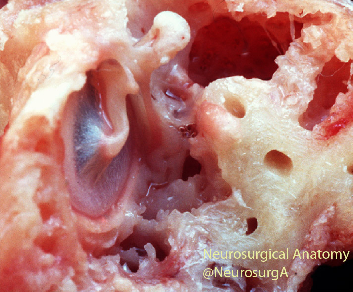 NeurosurgA's tweet photo. Can you hear me ?
Tympanic membrane and middle ear
#anatomy #neurootology #middleear #ear #tympanic https://t.co/a37mecIrla