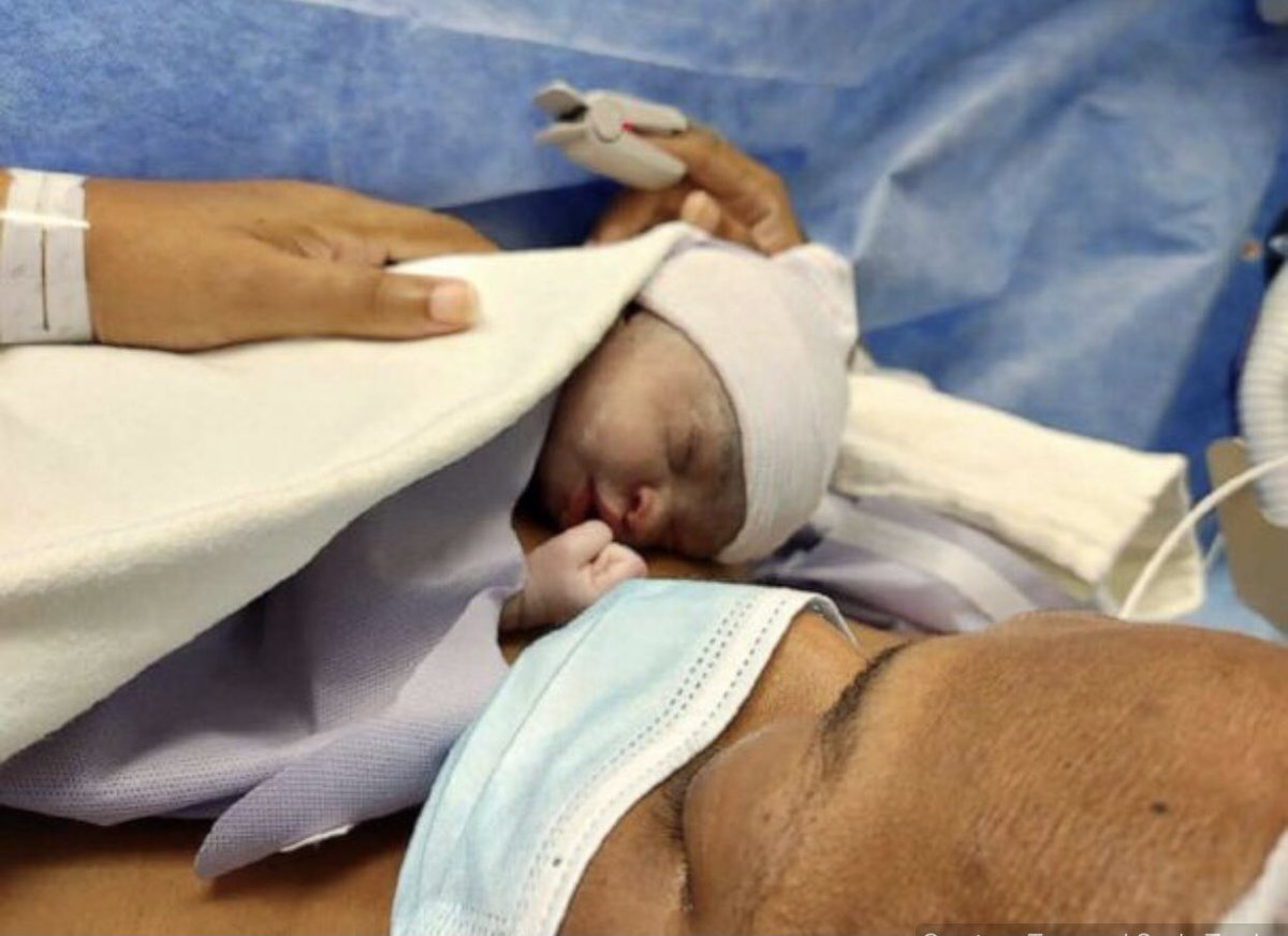 BcrWorldwide's tweet photo. 'Miracle baby:' 50-year-old woman gives birth to first child, after years of infertility 🙏🏿❤️ https://t.co/9KmHFpOOpI