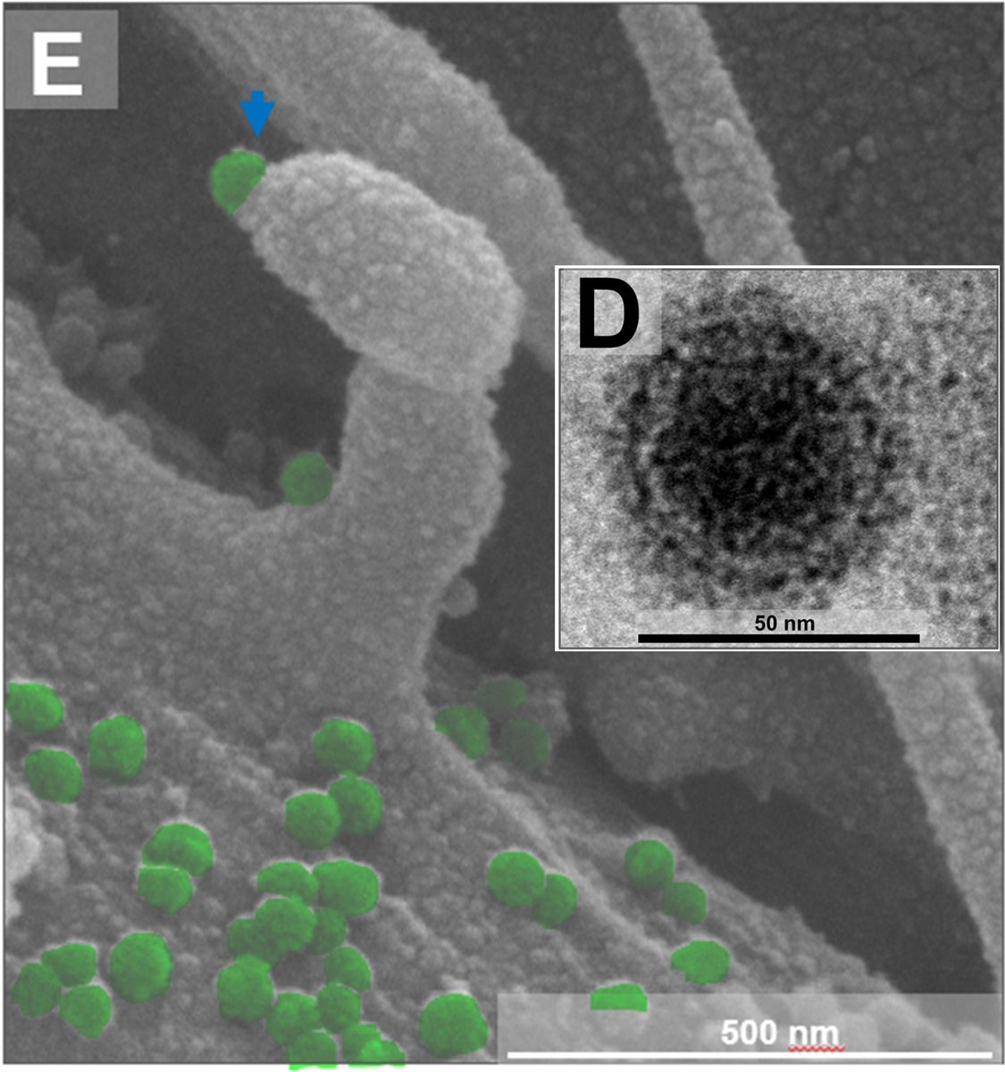 Reis_EVS's tweet photo. Exploring CHIKV biology and life cycle obscurities, check out our work published (ahead of print) at the #JournalOfVirology.
So thrilled! 

In-depth characterization of the CHIKV replication cycle.

#LoveVirology #Virology #Chikungunya #JVI #Microscopy  
https://t.co/KwvdLoSlBT https://t.co/oqT8eBZicv