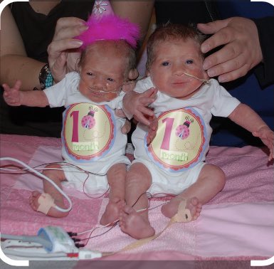 beck8535's tweet photo. Today is #WorldPrematurityDay! Did you know that 1 in 10 babies are born too soon? Emmy and Claire were born at 29 1/2 weeks, 3lbs and 2lbs and in the NICU for 42 and 56 days! We are so thankful to the NICU nurses and @MarchofDimes for the happy, healthy girls we have today! https://t.co/UqueDpp6BV