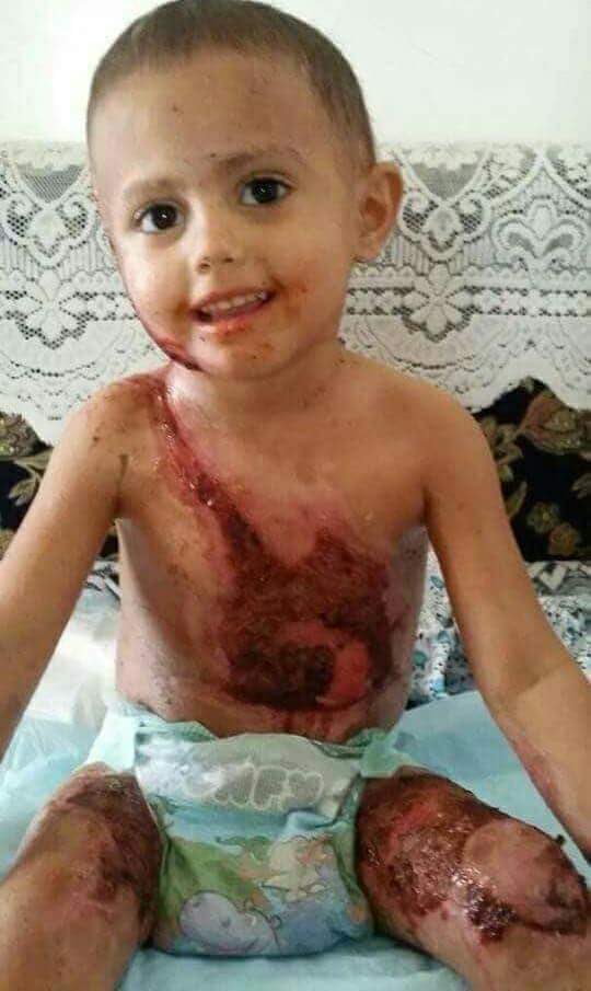 AliAlmo61378183's tweet photo. قول  لهم  ياسندباد انا اليمني المثابر هذه الاثار ساتذكرها يوما واقتص منكم ايها الاوغاد ياعتات المجرمين وساقهركم ورغم جراحي وحرقي بقنابل النابالم سياتي اليوم الذي اضحك فيه عليكم يااوغاد ايها المجرمين وابناءالخنازير https://t.co/5Jk5xK2Heg
