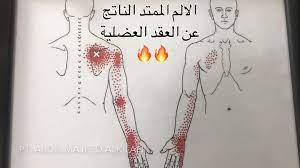alshifa_care's tweet photo. أسباب تكون العقد العضلية:
- الإجهاد المتكرر على العضلة
- ضعف العضلة
- الجلوس الخاطيء 
تجنب تكون العقد العضلية: 
- تحسين اللياقة البدنية 
- تمارين التقوية للعضلات 
- الجلوس بشكل مستقيم وتجنب انحناء الرقبة والظهر
- عدم تجاهل الشد العضلي والتوجه لأخصائي العلاج الطبيعي https://t.co/XaROj9u0Ir