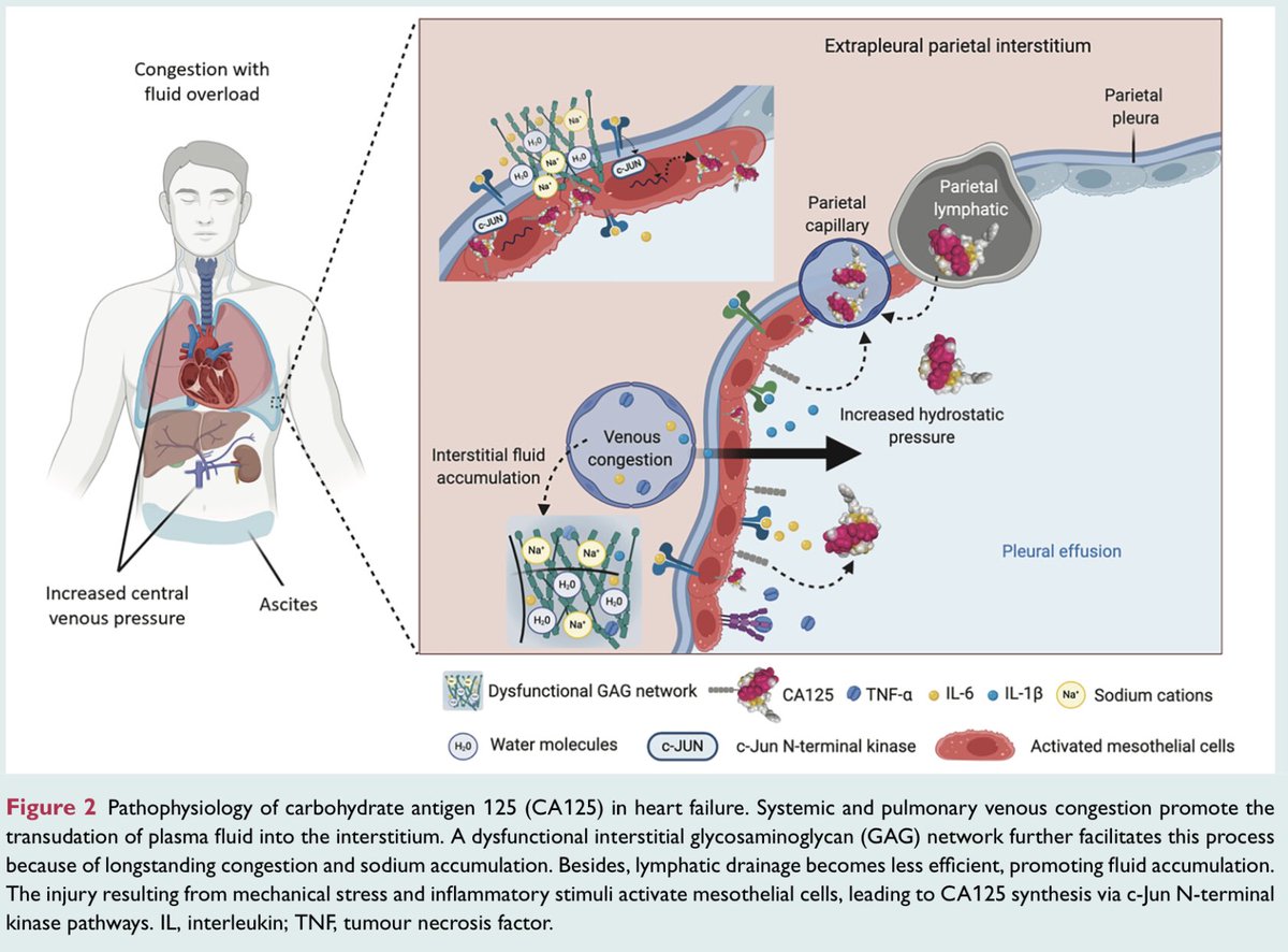 Fisiopatología del antígeno de carbohidrato 125 (CA125) en la insuficiencia cardíaca:

European Journal of Heart Failure 2021; DOI: 10.1002/ejhf.2295