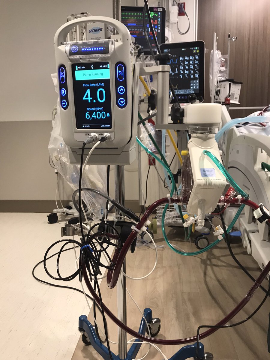 GCudemusMD's tweet photo. First Use of #ProtekDuo dual lumen to provide #VVECMO and #RVSupport for #ARDS #COVID19 at @NCHFlorida @NCH_Heart .Congratulations to our #MCS team @DrBrianSolomon @StephenDorazio2 @md_viviana. Thanks to our leadership @PaulHiltz @RCubedduMD https://t.co/KNvoc6eG9f
