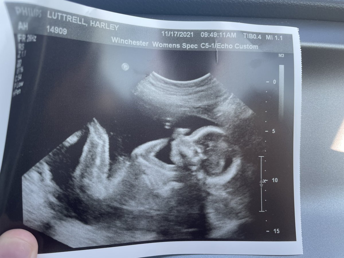 r_car7's tweet photo. I can’t wait to meet you lil buddy! ❤️ I can’t wait to spend every second I can building a great bond with you https://t.co/MM345H15Jy