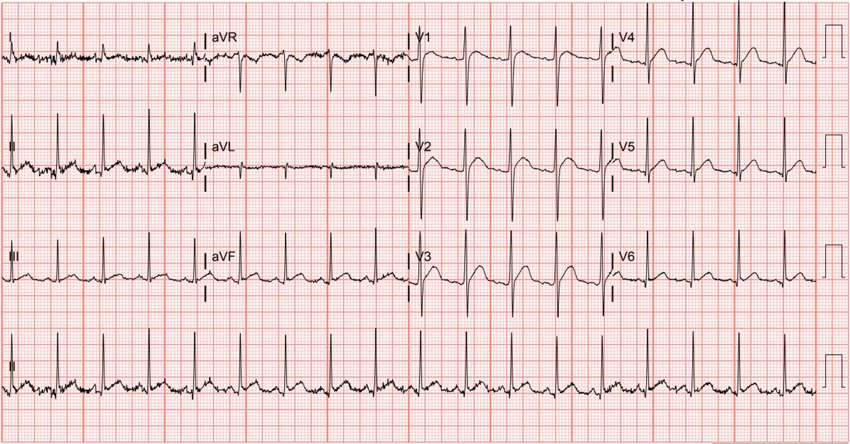 We’re doing a GIVEAWAY! Reply with the correct diagnosis and you’ll be entered in a drawing to win a copy of our book! It’s as easy as that 🤗. Three winners now, more to come. 

Patient presents with vague symptoms of fatigue. What’s the diagnosis?
