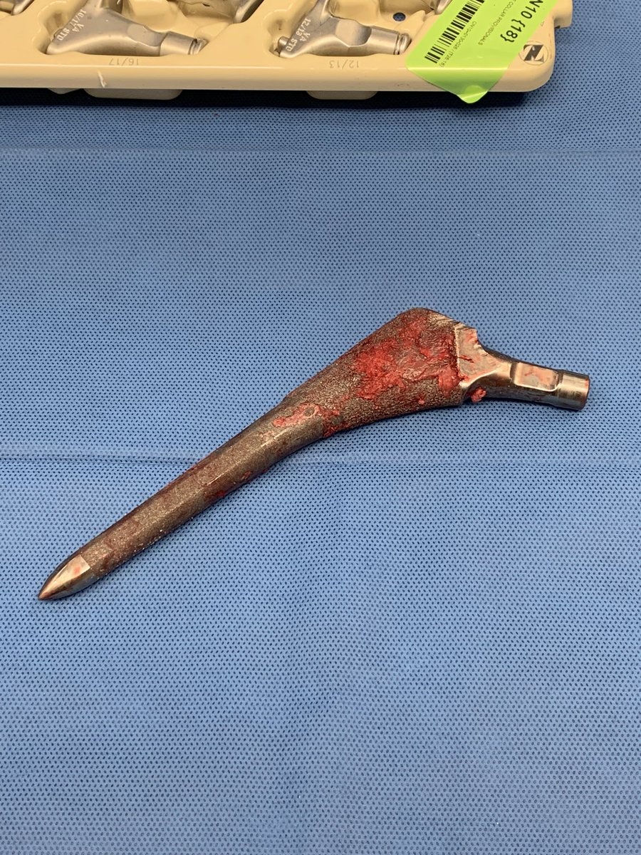 Another win for the patient… 12 minute extraction and #noeto #orthotwitter