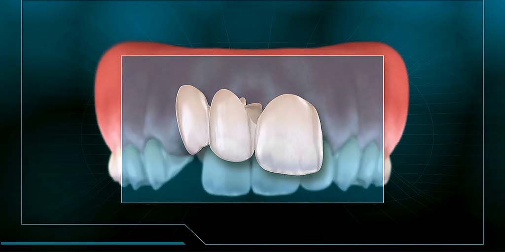 Precision Dental Care LLC (DrAfkari) Twitter