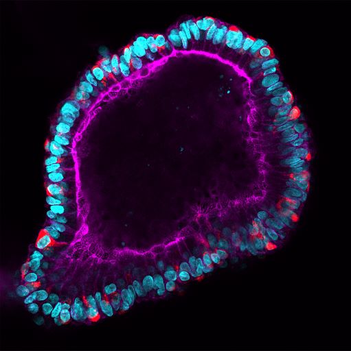 asm_tmc's tweet photo. This #FluorescenceFriday as we're digesting yesterday's Thanksgiving feast, let's appreciate the beauty of our #digestivesystem, as shown by @SaraDiRienzi's gem of an intestinal #organoid
@BrittonTML #bioart #microscopy #stilldigesting #organoids #lablife #MicroWorld https://t.co/P9VxbKi9of