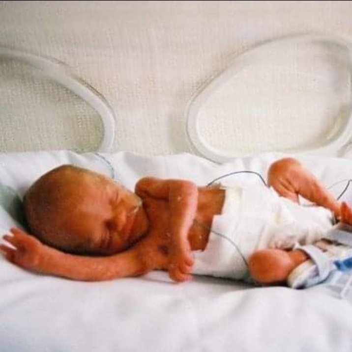 Jason7Stanley's tweet photo. @JoFamilyLaw Great Post Jo. One of my twins high fiving me before I was able to hold her #WorldPrematurityDay https://t.co/BaXgXc8HTW