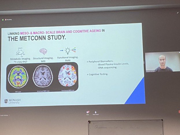 First conference presentation of the candidature! Thanks for the opportunity to present my work this far! 🧠📝

Brain Ageing &amp; the METCONN study at #ACNS2021