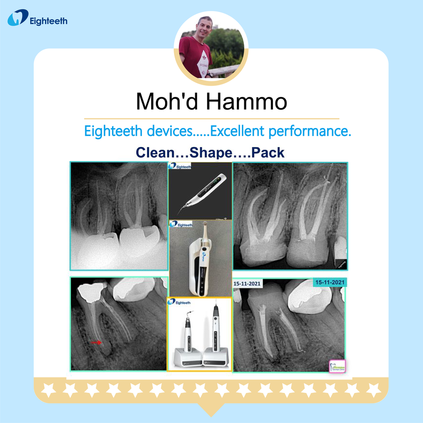 Eighteethdent's tweet image. "𝐄𝐢𝐠𝐡𝐭𝐞𝐞𝐭𝐡 𝐝𝐞𝐯𝐢𝐜𝐞𝐬...𝐄𝐱𝐜𝐞𝐥𝐥𝐞𝐧𝐭 𝐩𝐞𝐫𝐟𝐨𝐫𝐦𝐚𝐧𝐜𝐞!"
Thank you Prof. Moh’d Hammo for your positive feedback! 🥰🥰
#Fastpack 
#Fastfill 
#endowitheighteeth