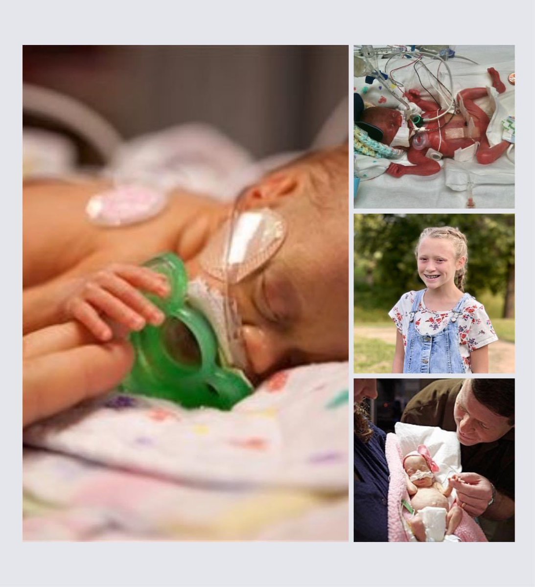 jimbobforar's tweet photo. Today we celebrate #WorldPrematurityDay! Our daughter Josie was born at 25 1/2 weeks gestation and weighed just 1 lb. 6 oz. We are so thankful for everyone’s prayers and all of the medical professionals at Arkansas Children’s Hospital that saved her life! https://t.co/wEkJhoaiZk