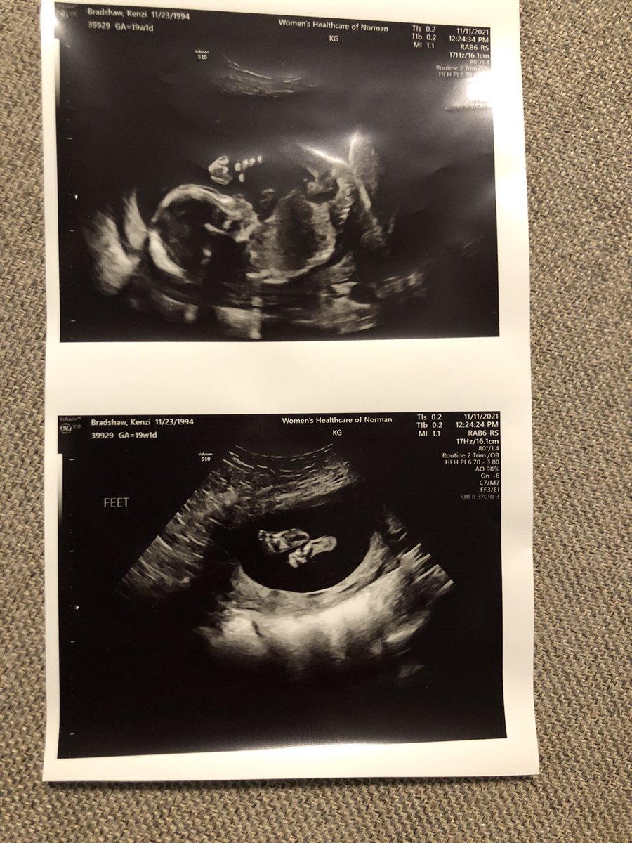 Baby GIRL Bradshaw coming this spring! Can’t wait to meet her🎀💗
#GirlDad