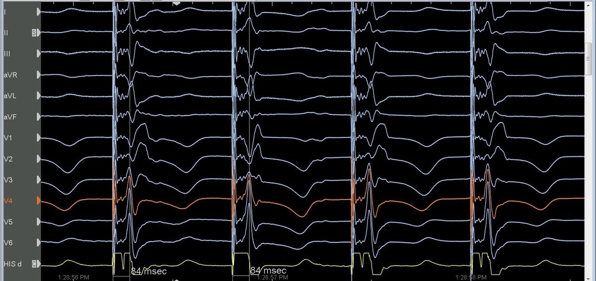 Mike Manogue tweet media