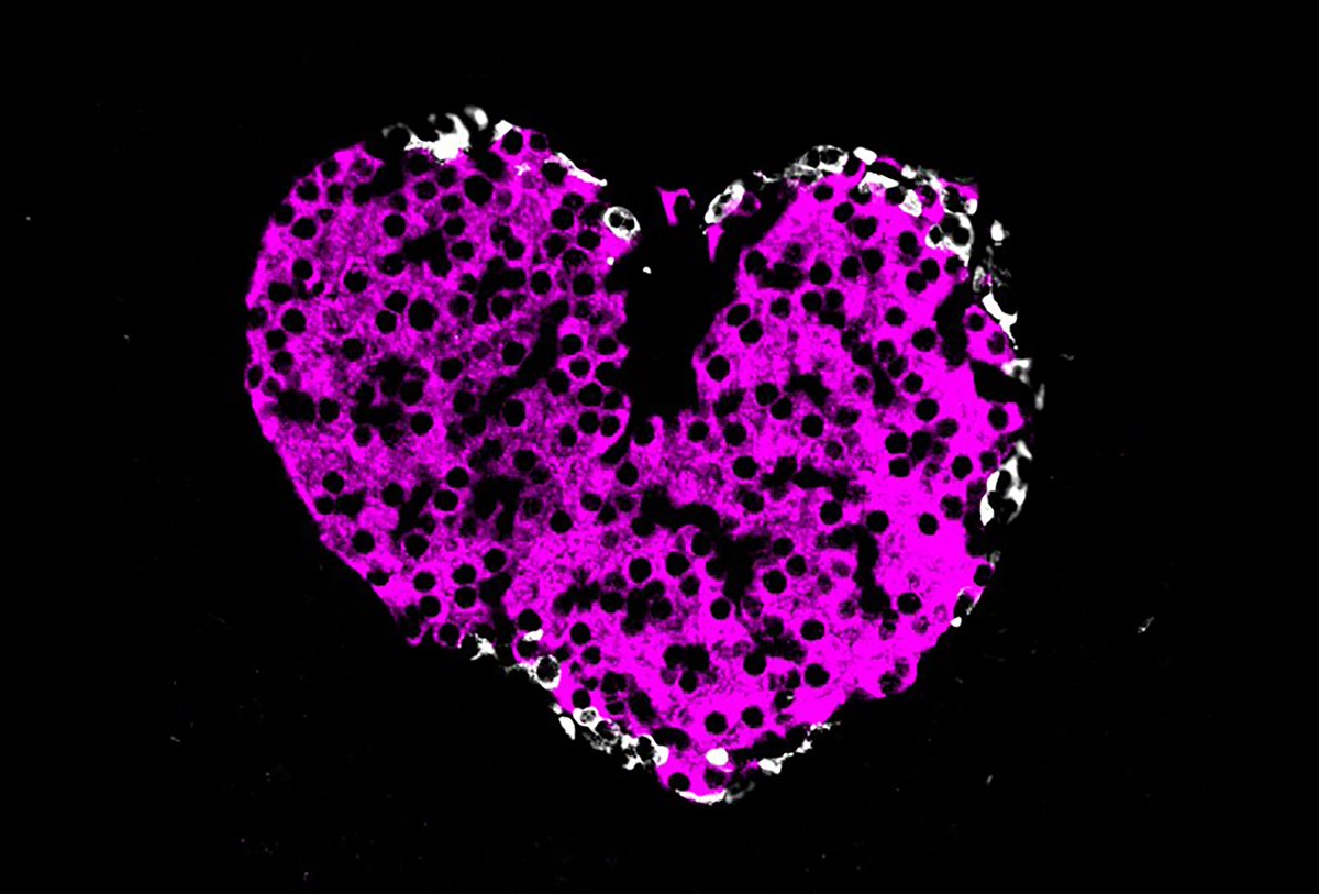 claudine_bonder's tweet photo. Today we are sending love to everyone who has lived experience of pancreatic cancer and advocate for the medical research which will turn this deadly disease into long term survival 🔬👊🏼
#WorldPancreaticCancerDay 
Image: pancreatic islet, credit @kay_mmin https://t.co/6mT6f6vNaI