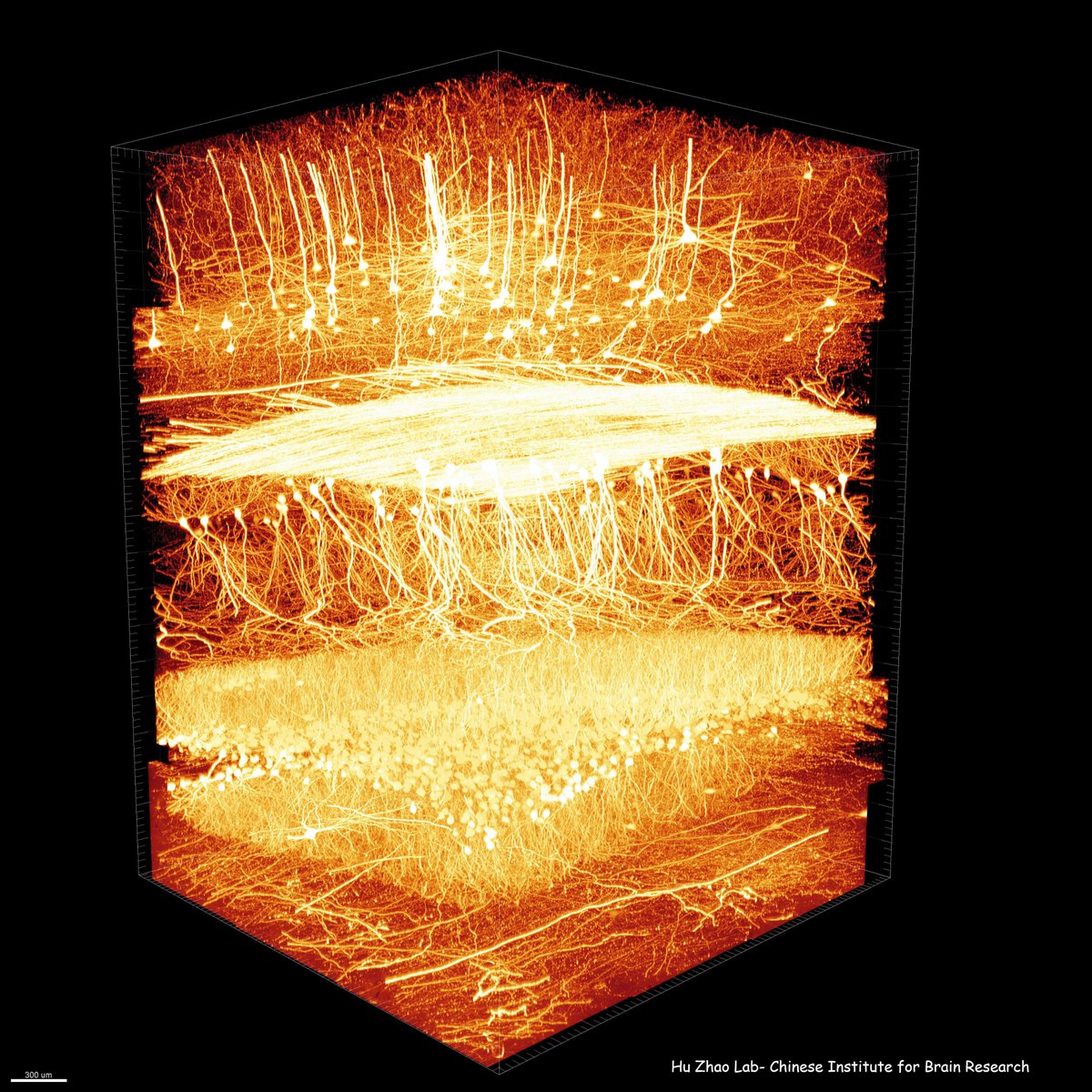 huzhao4's tweet photo. beauty of neuroscience. I can sit in front my computer watching these images for hours. https://t.co/pHF49C1fEm