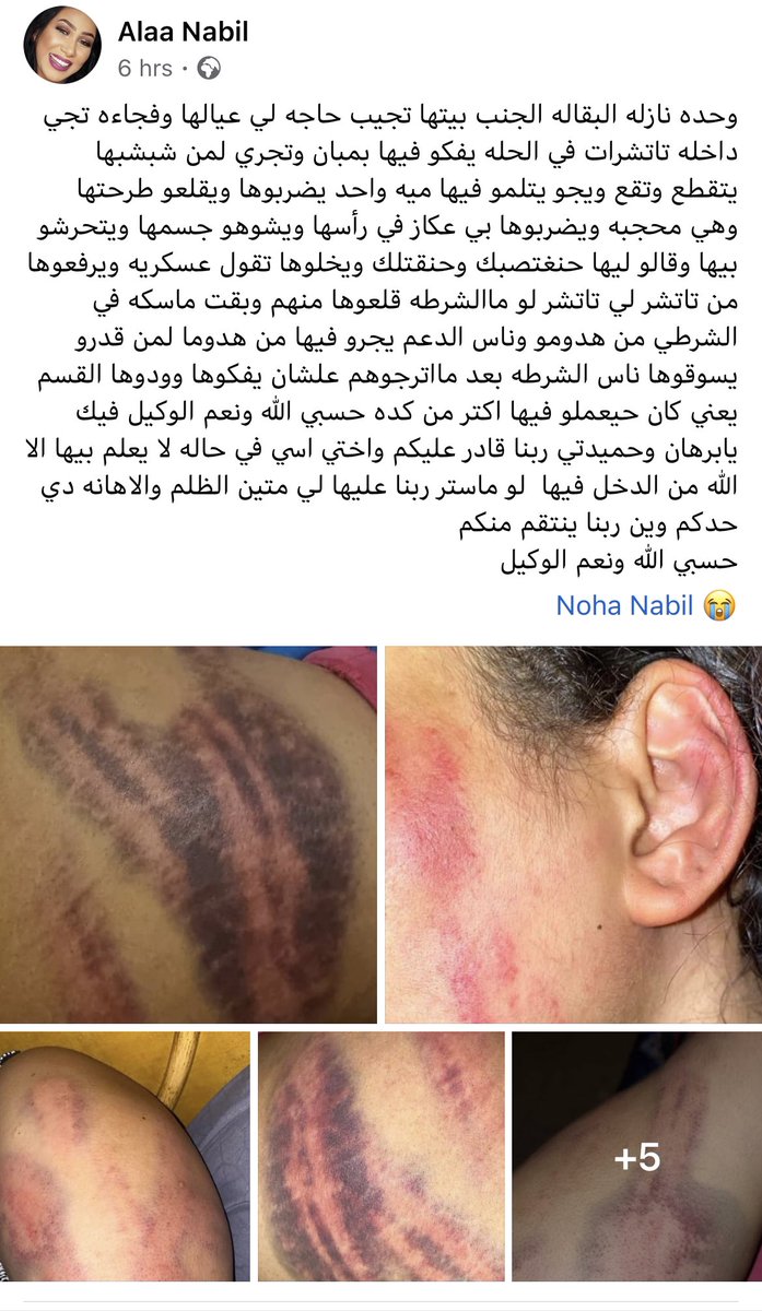 AbdallaElhillou's tweet photo. مليشيات دقلو اخوان، تتحرش بنساء السودان ويه��دونهن  بالاغتصاب ويعتدون عليهن بالضرب ويسحلونهن بالارض.
لعنة الله عليكم .
#مجزرة17نوفمبر https://t.co/yjiSB46x9c