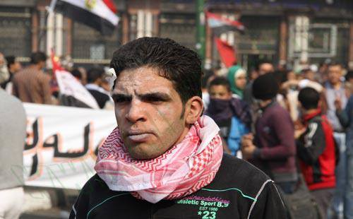 amal_hadad's tweet photo. 22 نوفمبر2011 
إشهد يا محمد محمود كانوا ديابة وكنا أسود
#محمد_محمود_مذبحة
#RememberMMahmoud
#اتكلم_عن_محمد_محمود
#ذكرى_محمد_محمود.#19_نوفمبر
#المجد_للشهداء https://t.co/wZFH0m0bPu
