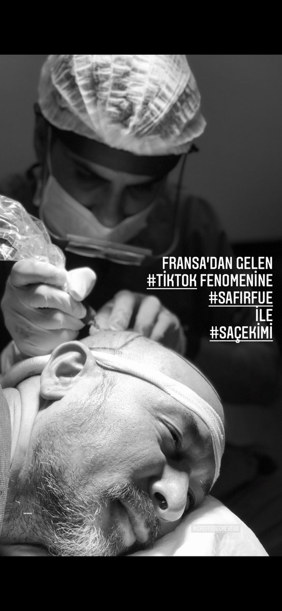 hakanikizoglu's tweet photo. #saçekimi #greffecheveux https://t.co/Ni1N1Tl3Wx