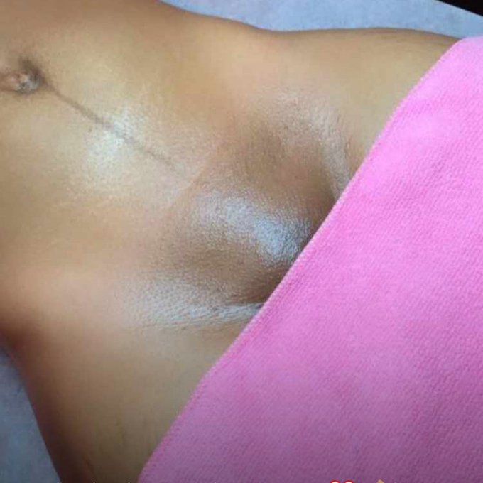 Vajacial treatment plug in Port Elizabeth 0633774121 Walmer https://t.co/lakA5psZHE<a href="/tag/thisbodyworksforme"class="tags"><span>#thisbodyworksforme</span></a>