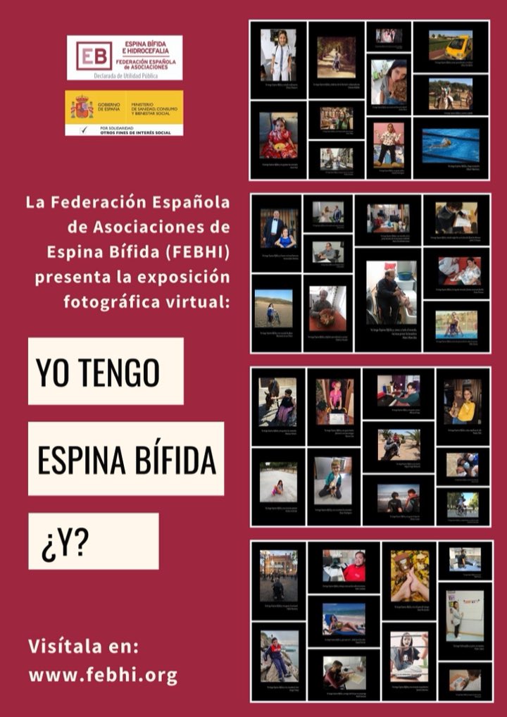 FEBHI_ORG's tweet photo. El #21Nov es el Día Nacional de la #EspinaBífida. Conoce a personas con esta malformación congénita en nuestra exposición virtual 
https://t.co/WXCpCcPJPQ
#DíaNacionalEB #YoTengoEB #FEBHI40 #DíaEB https://t.co/ryaaO9cJ8K