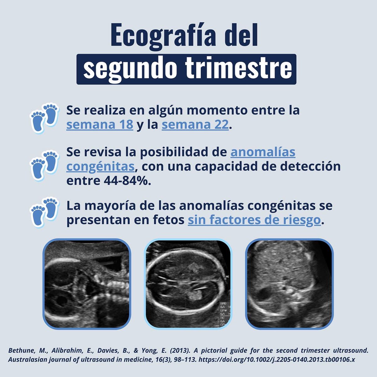 kathypose's tweet photo. Ecografía del segundo trimestre de embarazo 🤰🏼, en mi opinión es el más importante, donde se revisa prácticamente todos los órganos y todo el cuerpo del bebé 👶🏻.
#tusaludsimple #embarazo #ecografía #pregnant #secondtrimester #3dultrasound #pregnancyultrasound #fetalabnormality https://t.co/iu8IGYR9Kz