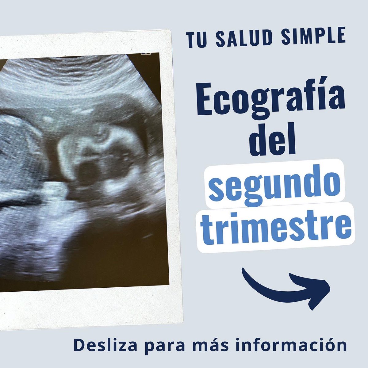 kathypose's tweet photo. Ecografía del segundo trimestre de embarazo 🤰🏼, en mi opinión es el más importante, donde se revisa prácticamente todos los órganos y todo el cuerpo del bebé 👶🏻.
#tusaludsimple #embarazo #ecografía #pregnant #secondtrimester #3dultrasound #pregnancyultrasound #fetalabnormality https://t.co/iu8IGYR9Kz