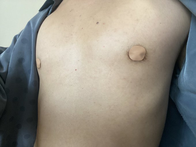 スポールバンを30時間ほど乳首にくっつけたあと、風俗に行って乳首舐めしてもらいました。。。 もうヤバかったです。ちろっとしただけで腰が天空へぶち上がりました。 本当にスポールバンで乳首開発できますねこれは。。。スゴすぎる。