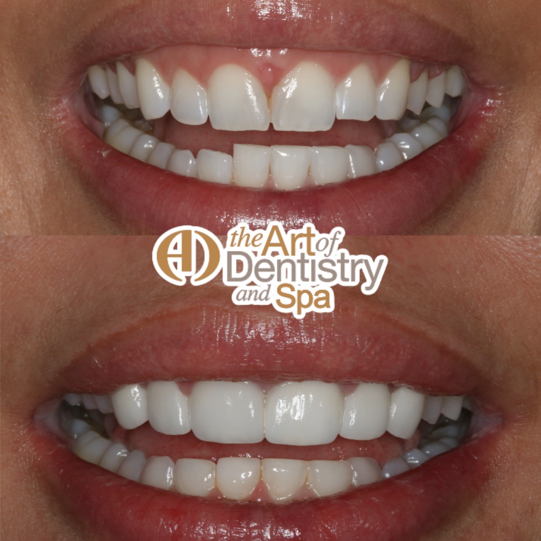 TheArtofDentistrySpa tweet media