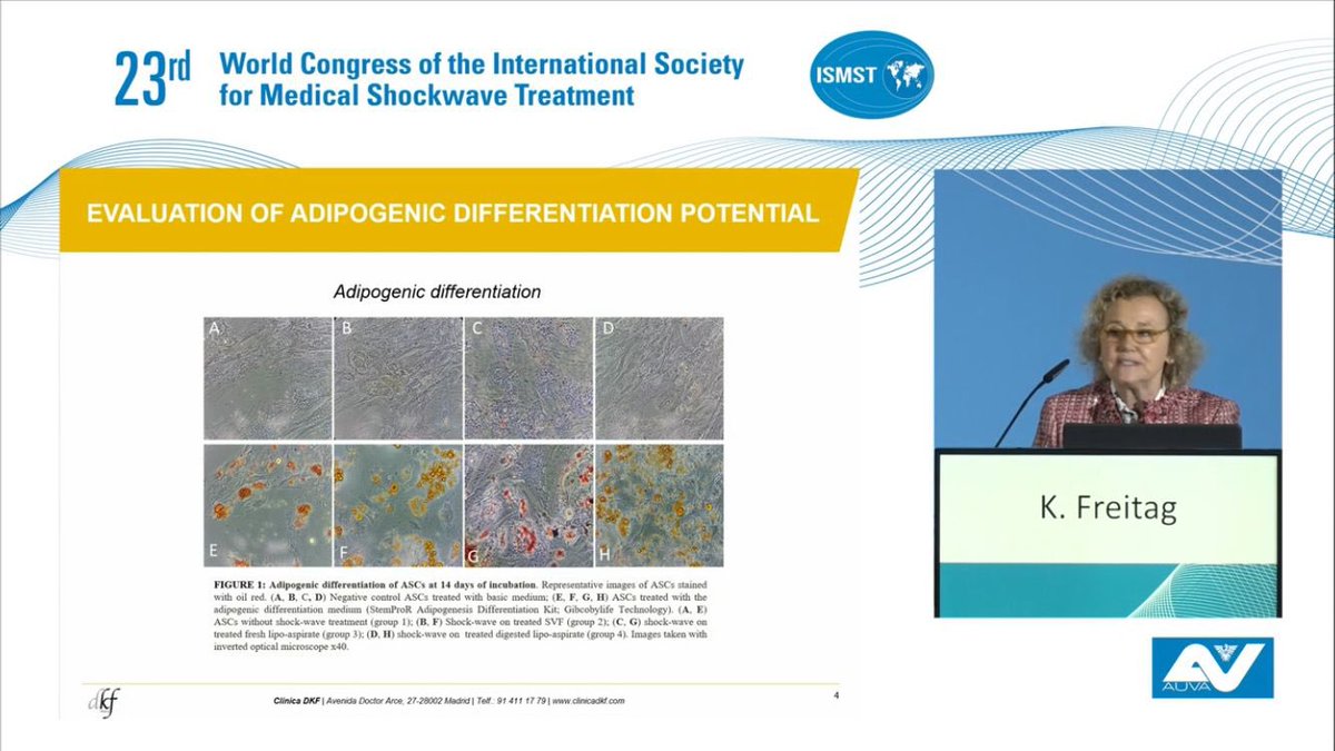 SETOCSETOC's tweet photo. Enhorabuena a nuestra compañera dra.Karin Freitag por sus conferencias en #ONDASDECHOQUE impartidas en el 23rd World Congress of the ISMST, en Viena,  celebrado este mes de Noviembre. 
#shockwave #medicaleducation #ciencia #ismst https://t.co/SD9yJbt8iP