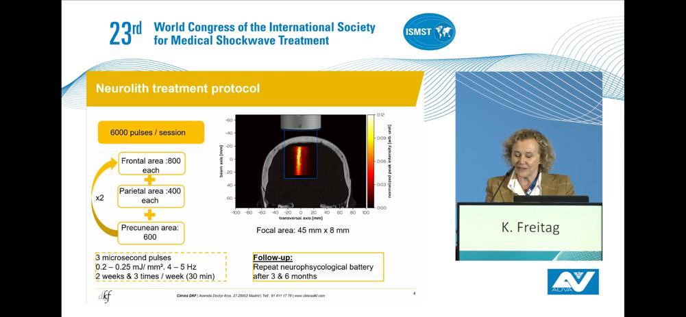 SETOCSETOC's tweet photo. Enhorabuena a nuestra compañera dra.Karin Freitag por sus conferencias en #ONDASDECHOQUE impartidas en el 23rd World Congress of the ISMST, en Viena,  celebrado este mes de Noviembre. 
#shockwave #medicaleducation #ciencia #ismst https://t.co/SD9yJbt8iP