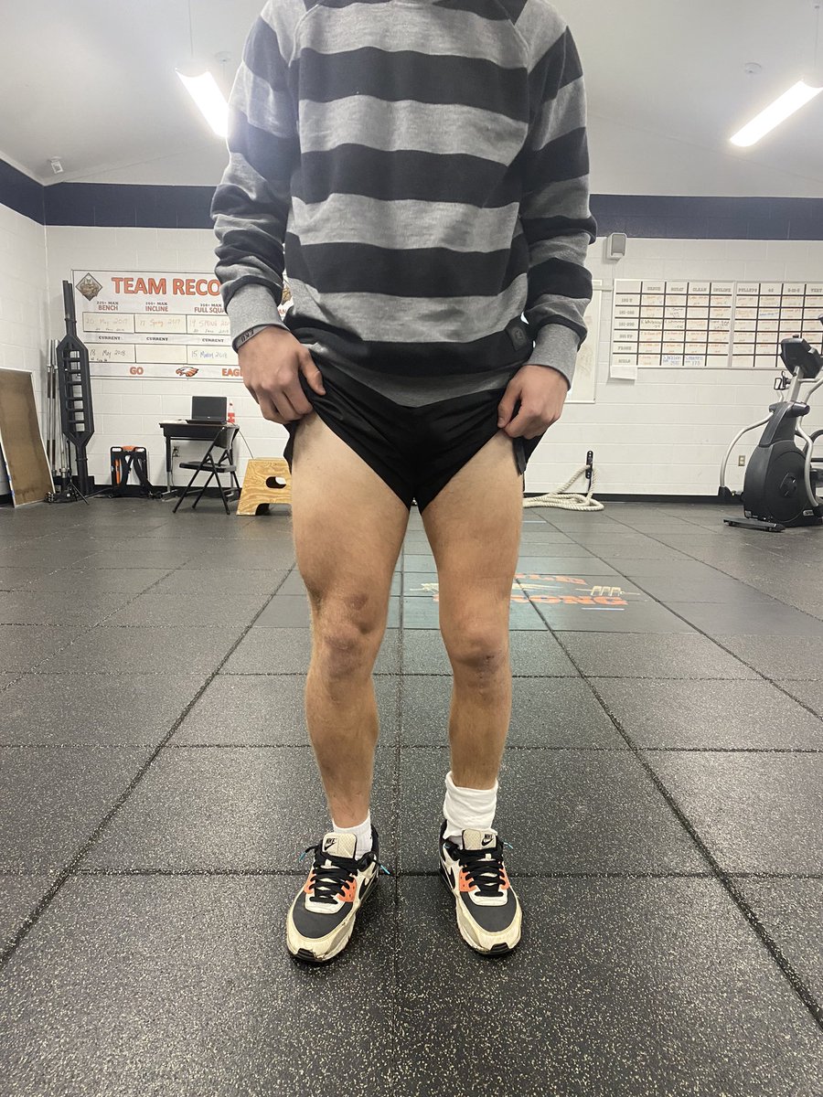 walter_smith_11's tweet photo. One month out of my acl surgery- I’ll keep you all updated on my recovery https://t.co/0IDrRQkoHa
