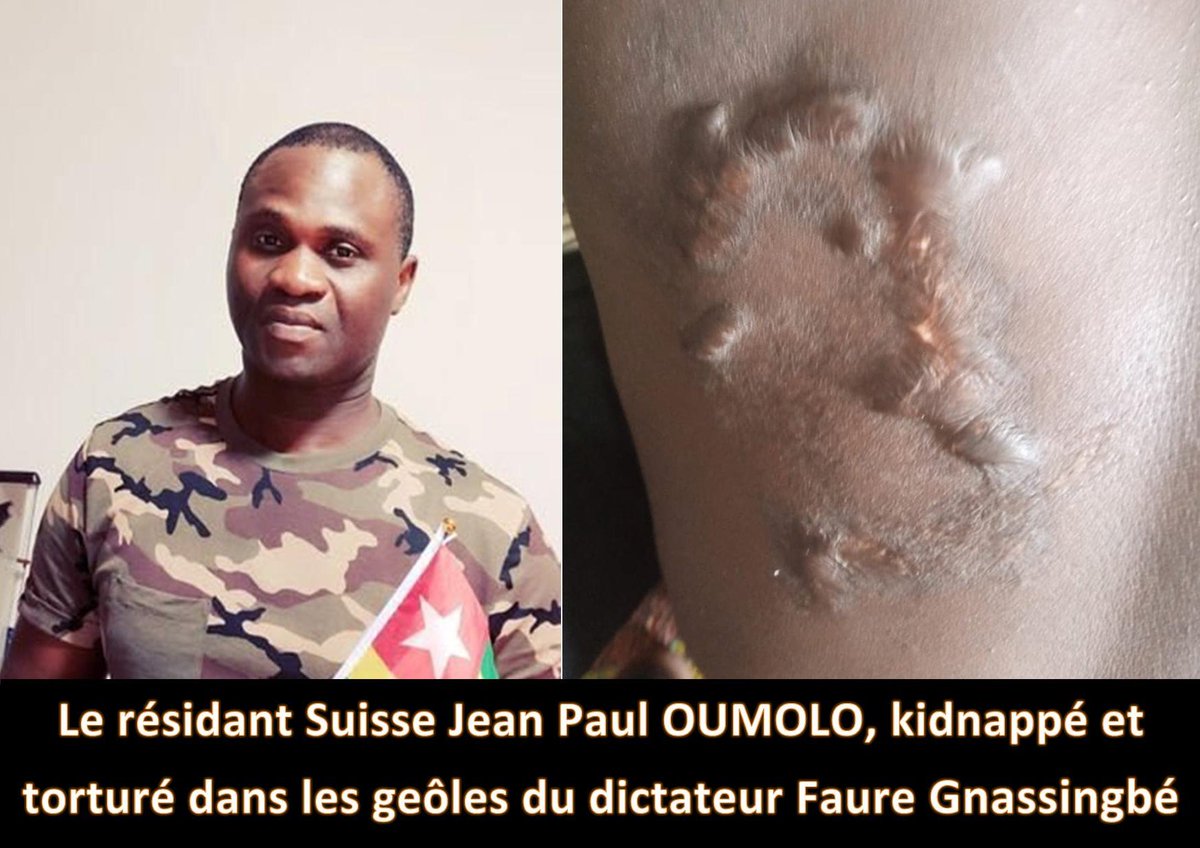 NAPOLETANONico1's tweet photo. L’Ambassadeur @Suisse au #Togo Philipp Stalder doit intervenir dans les plus brefs délais pour exiger la libération du ressortissant Suisse #Jean_Paul_OUMOLOU
Détenu depuis le 04/11/2021, JPO qui continu à être torturé ne s’alimente plus
@antonioguterres @amnesty @EmmanuelMacron https://t.co/4iH7RqLamY