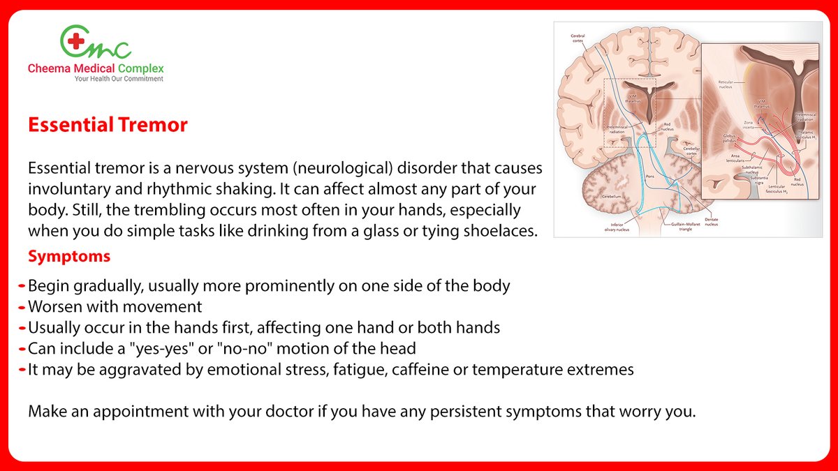 CMCmohali's tweet photo. Essential Tremor and its Symptoms
For the best treatment, visit #CheemaMedicalComplex, Mohali. For Enquiry, call us on 0172-4008070, 8054922340, 9876405771. https://t.co/vSoP9U4FTw