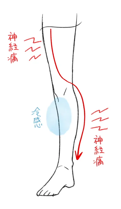 座ると悪化するので座れない足 