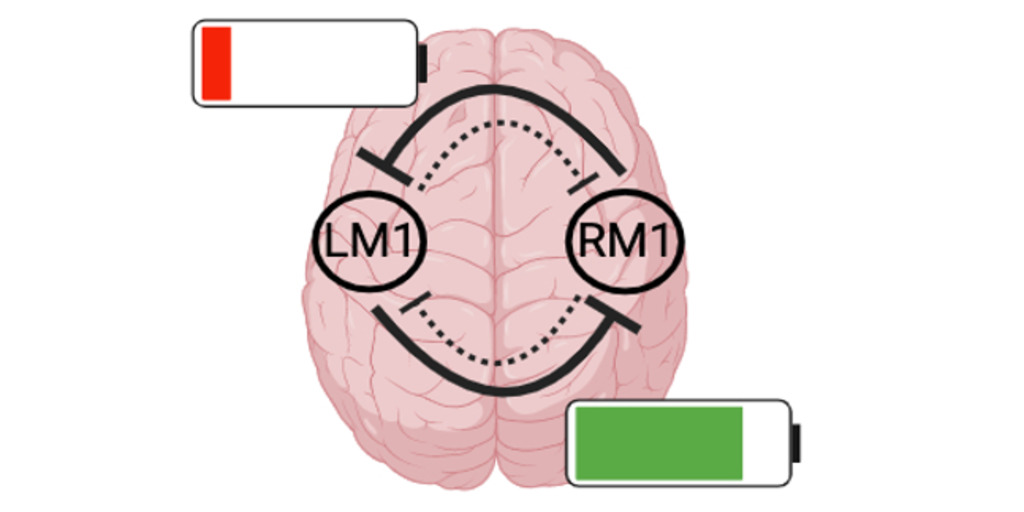 Ondobaka et al. report that subjective post-stroke fatigue can be explained by an imbalance in inter-hemispheric inhibition, revealing a new mechanism that could ultimately serve as a therapeutic target. bit.ly/3Ft1GKE