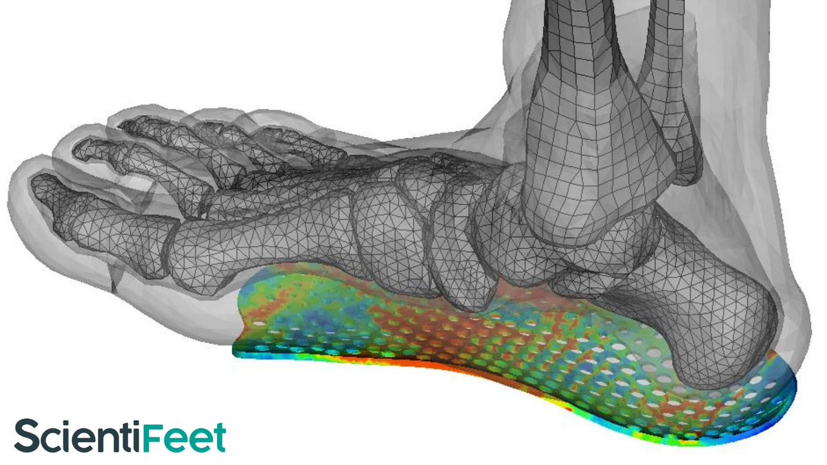 ScientiFeet's tweet photo. #podologue #podologie #podologia #pharmacy #pharamcie #Sante 
Retrouver plus d'informations sur notre site web : https://t.co/BDBbFZiEZN https://t.co/GG5eHx04bR