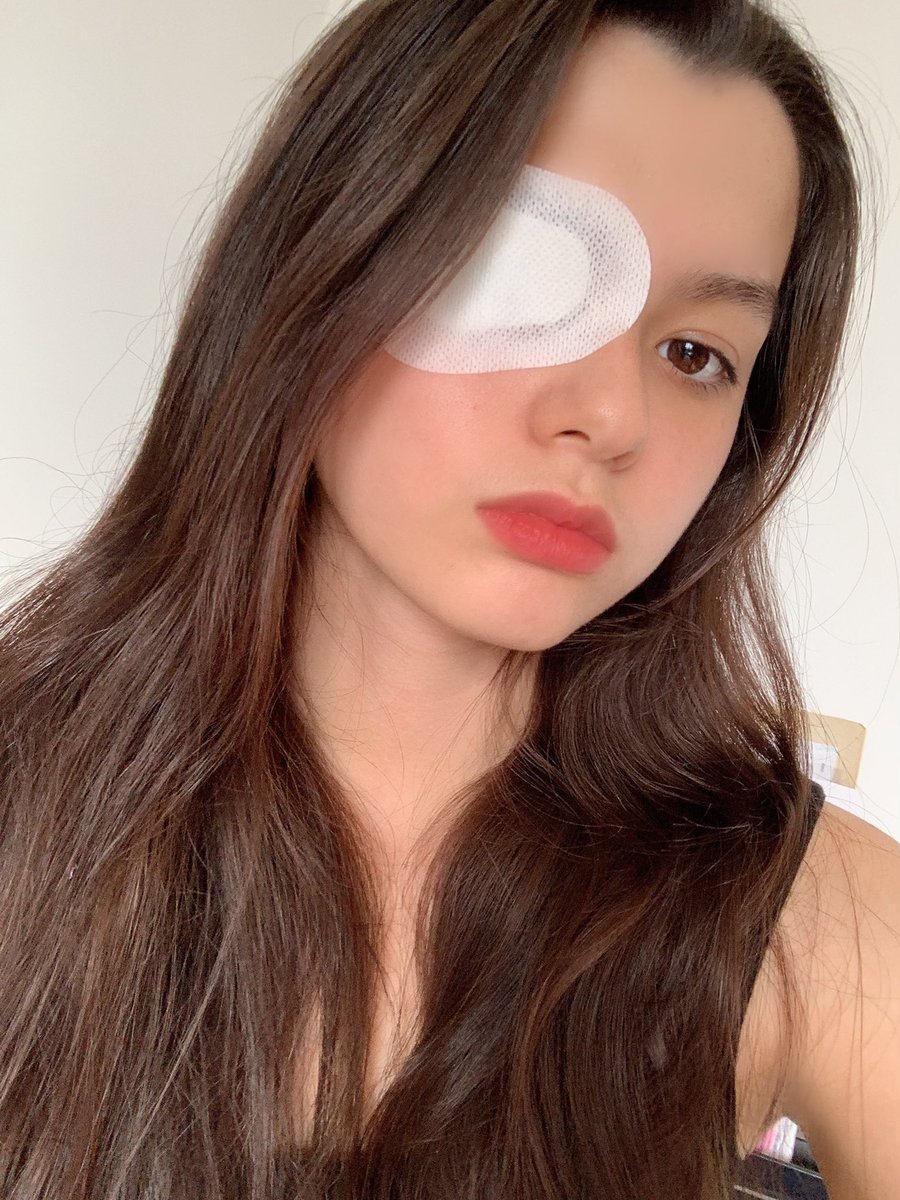AngelssBecky's tweet photo. Eye injury🤕 แล้วหนูจะสอบยังไงงแง้🥺😭 #beckysangels https://t.co/pg2N5ZWmRz