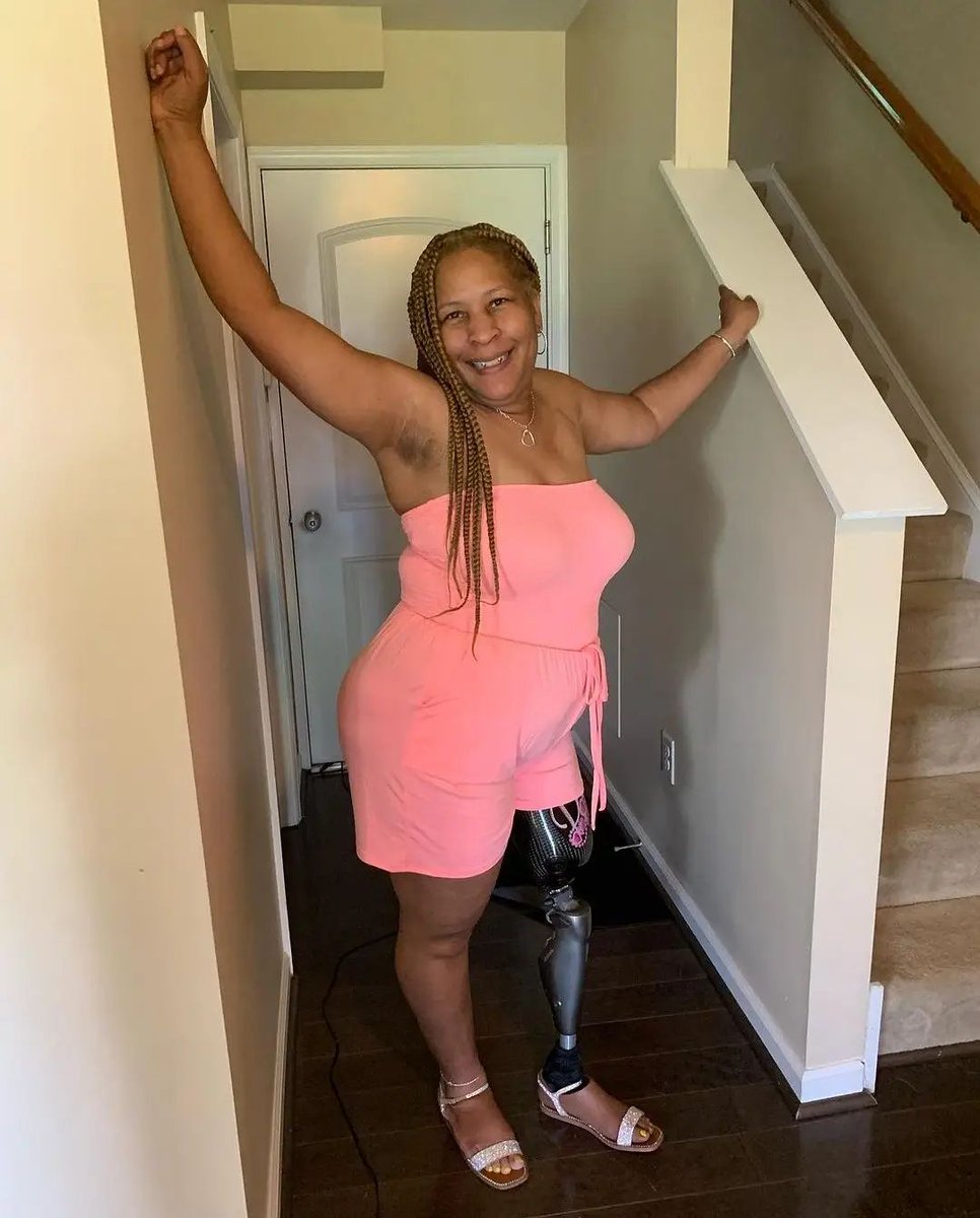 Happy 10 Year Ampuversary to <a href="/mecarney/">Mary Carney</a>! You're such a tough and resilient fighter that has inspired and encouraged many! Keep winning and being fabulous! 🎉🎉🎉
#prostheticinnovations #prosthetics #prostheticleg #prosthesis #akamputee #prostheticsolutions #prolimb #believeachieve