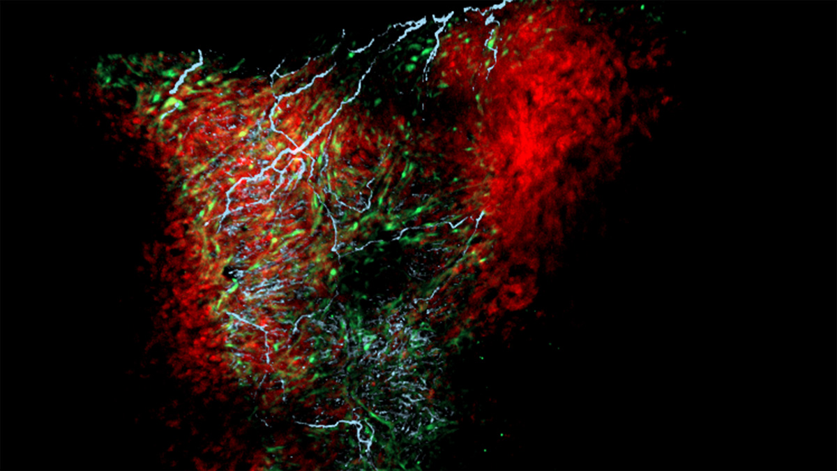 New cell, shown to regulate heart rate, discovered at University of Notre Dame go.nd.edu/80bd02
