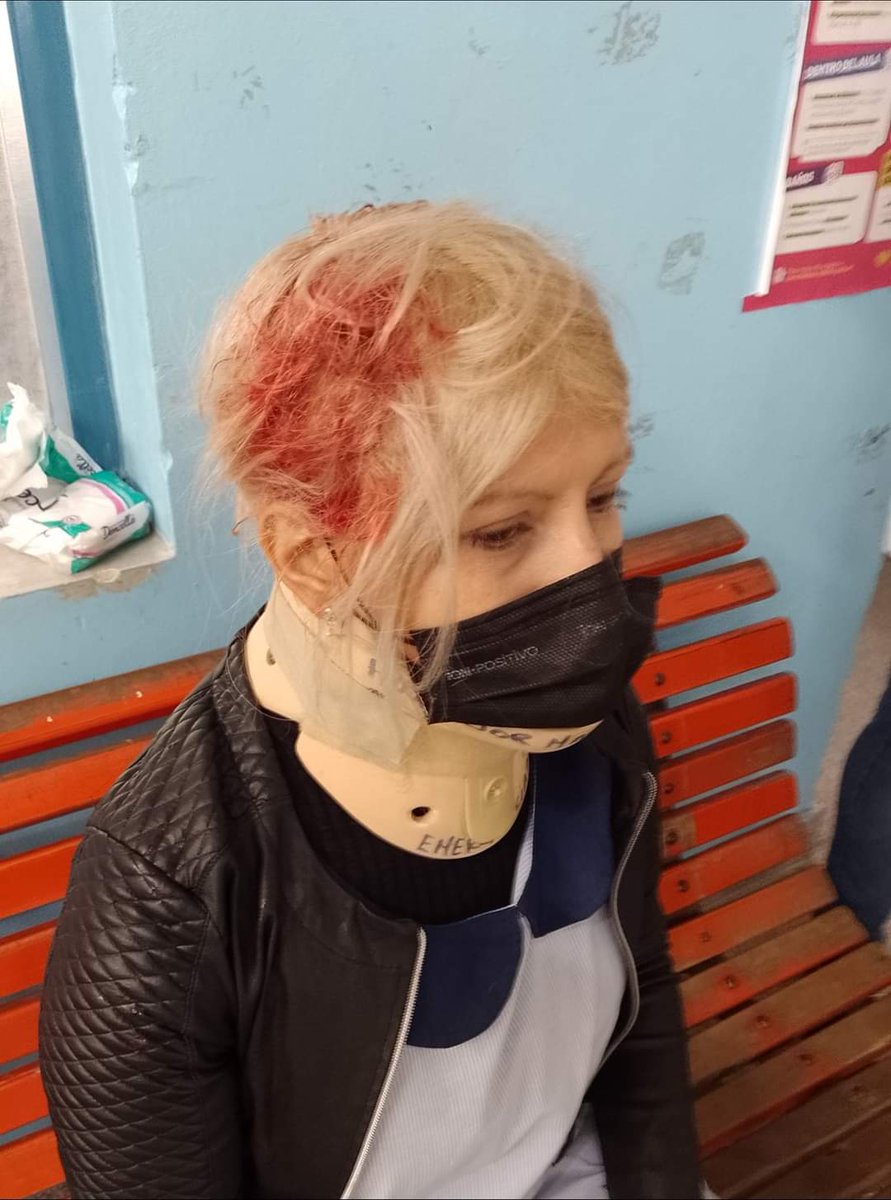 Mariadiazreck's tweet photo. Gravisimo: Se cayó una ventana en la escuela Primaria 24 de Villa Elisa ( #LaPlata)  e hirió a la maestra Estela Saavedra en la cabeza. Escuelas #Cromagnon!
#elestadoesresponsable 
Toda nuestra solidaridad con la compañera. https://t.co/6nBFq6BqrK