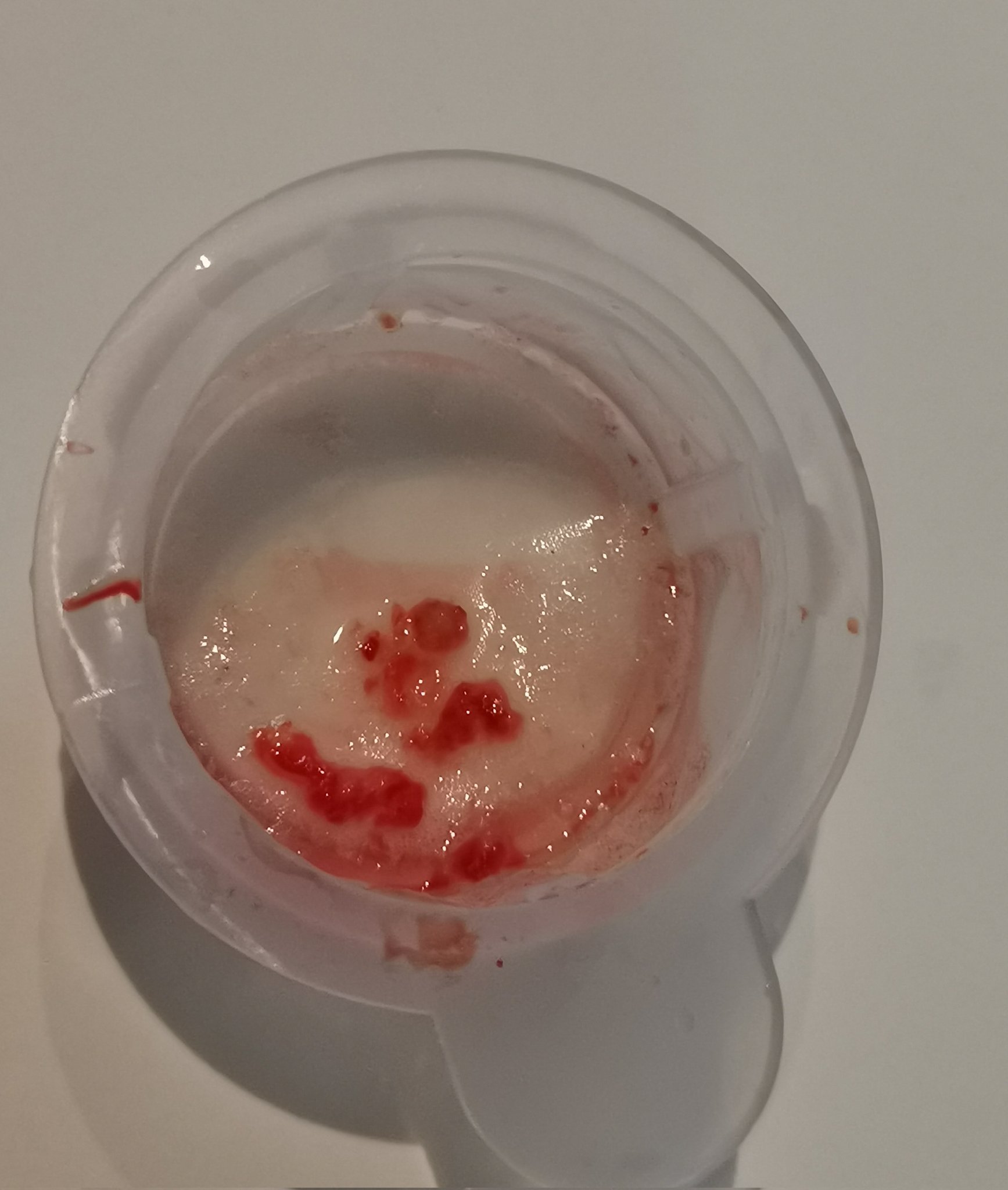 What Is Frothy Sputum With Pictures vrogue.co