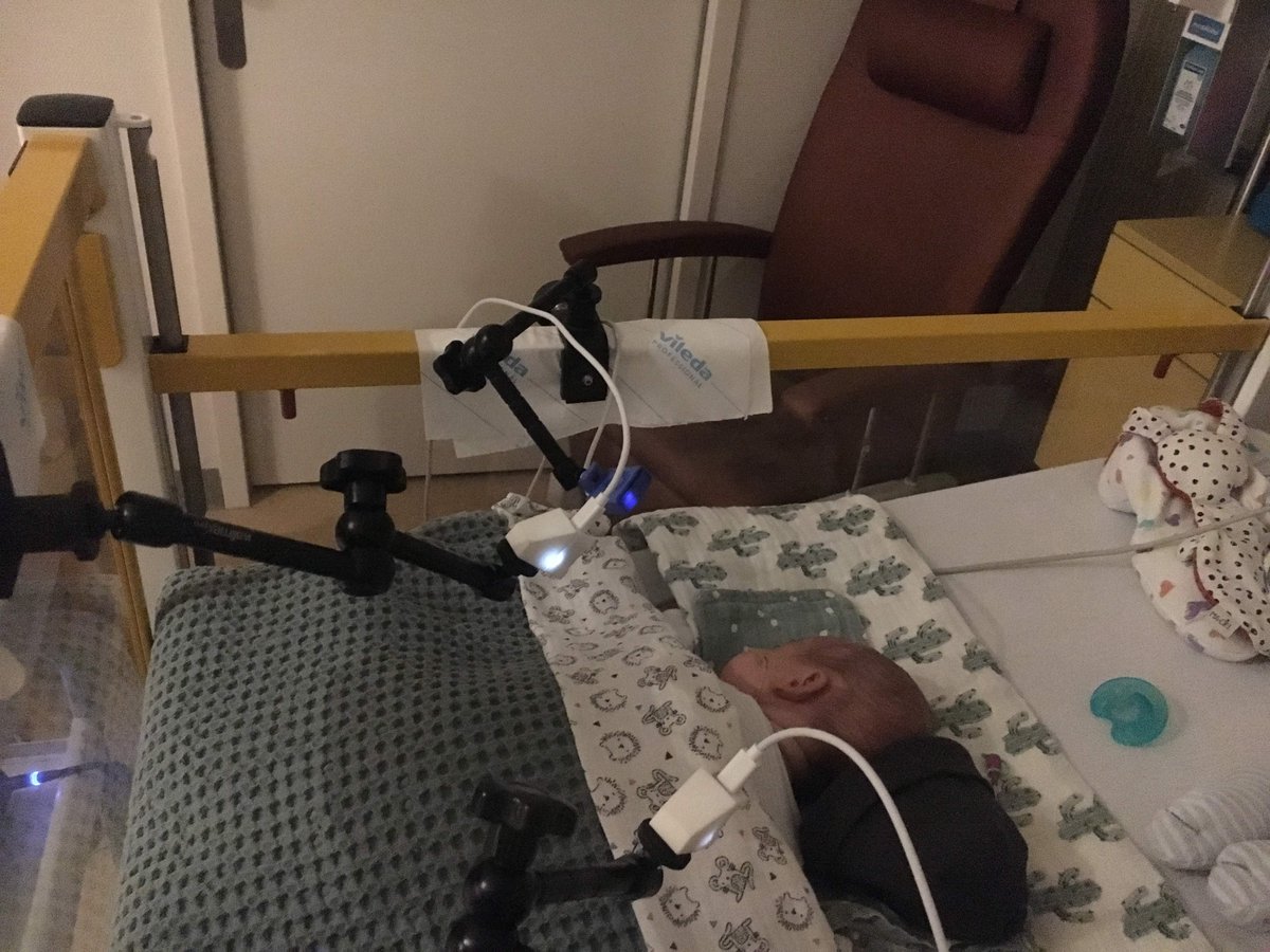 Monitoring op afstand minder belastend voor baby’s met apneu: mmc.nl/kindergeneesku… Hoe infraroodcamera’s, slimme algoritmes en een intelligente fopspeen te vroeg geboren baby’s kunnen helpen. #innovatie #promotieonderzoek #NICU 
<a href="/TUeindhoven/">Kumar Dhistraj</a> <a href="/PhilipsNL/">Philips Nederland</a>