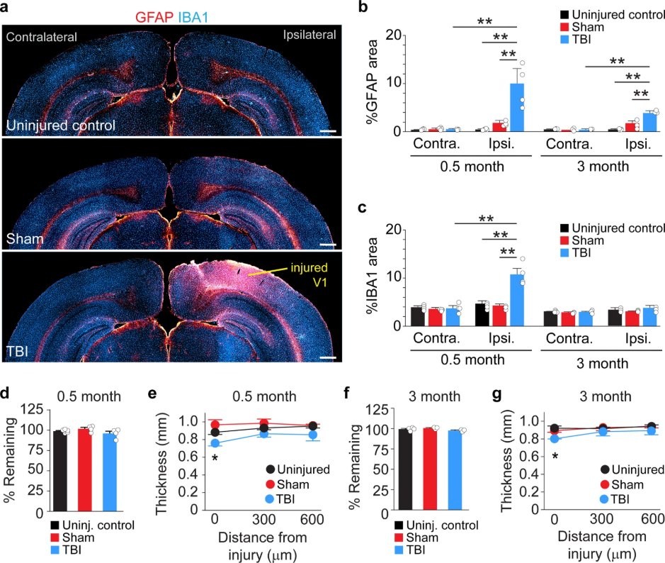 @hunt_lab @frankowskiJC @alexa_neuro @dclyonneuro and colleagues characterized deficits in the primary visual cortex of mice after traumatic brain injury that suggest impairment to V1 neurons. @UCIrvineSOM, @AnatomyNeurobio nature.com/articles/s4200…