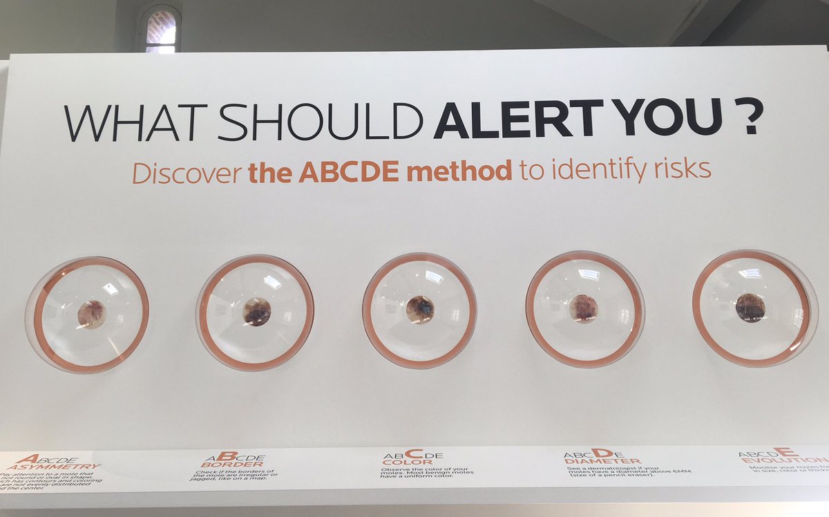LaRochePosayInt's tweet photo. Are you familiar with the ABCDE method to detect #anomaly in #moles? Beware of mole Asymetry, irregular Borders and Color, see a #dermatologist if Diameter is above 6mm, and monitor Evolution. Remember that knowledge can save lives 💙 #LaRochePosay #Dermlive https://t.co/azB0kxAxaG