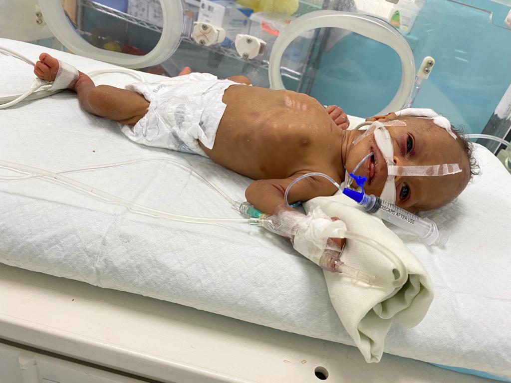 NiecyToby's tweet photo. Emergency C Section 
Birth Weight 3lbs
Diagnosed with Edward syndrome 
They said you wouldn't make it
Spent the first month and a half fighting for your life in Nicu. 
Now the doctors are in shock wondering how are you still alive.
Meet Xaidyn Sebro 
My Miracle Baby https://t.co/pSJMhiq7LS
