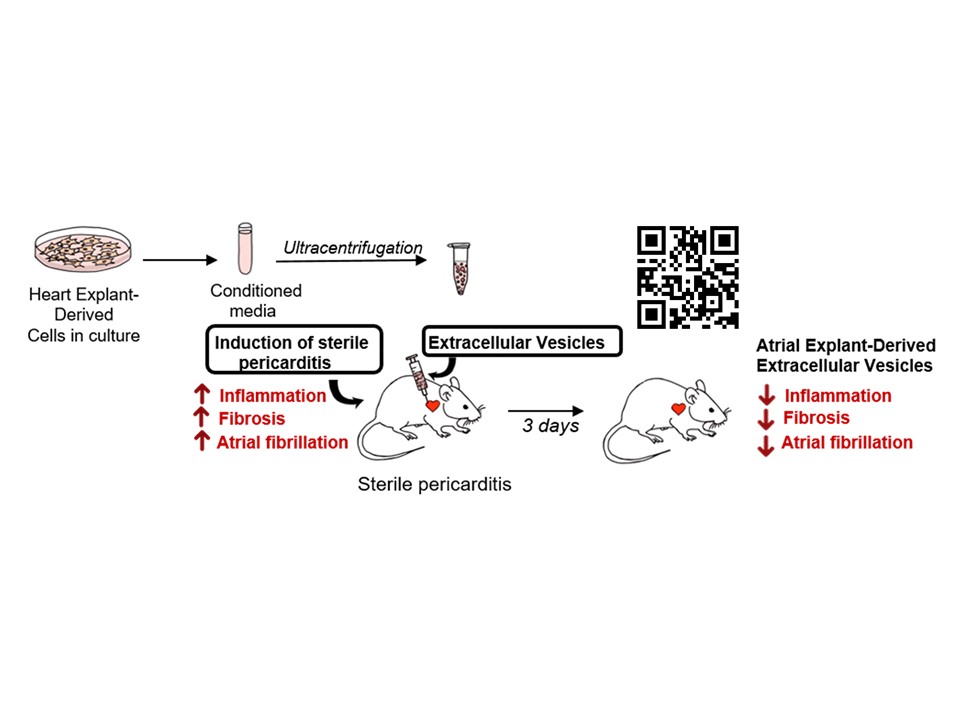 Extracellular vesicles from heart stem cells prevent post operative atrial fibrillation by reducing fibrosis and inflammation. #AHA21 #Afib aha.apprisor.org/index.cfm?k=96…