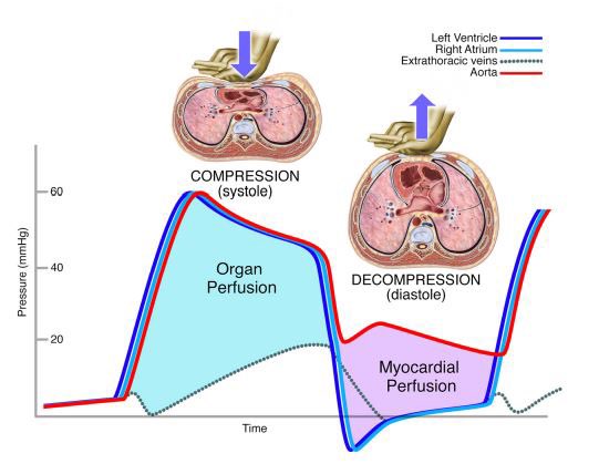 DavidMLaCombe's tweet image. Quality Matters:

▫️Compress: Perfuse the brain 
▫️Recoil: Perfuse the heart

🔻 Excessive compression rates lead to reduced cardiac output

🔻 Less than full recoil reduces cerebral perfusion pressure by 1/3