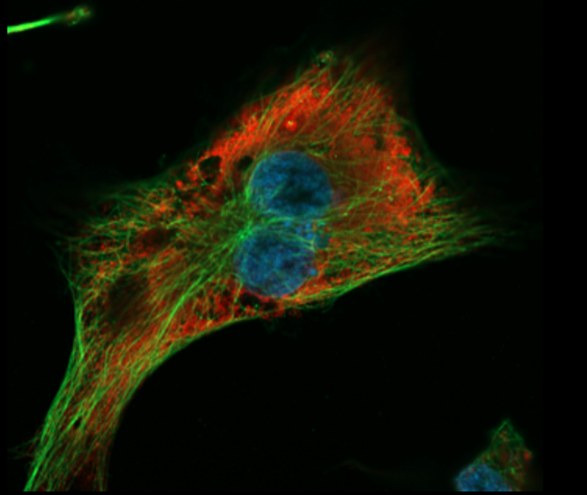 Curiou16's tweet photo. The #Cytoskeleton from two different perspectives! Thanks to @dsgoodsell for sharing this exquisite painting, featuring a microtubule undergoing "catastrophe" and a bustling cytoplasm. This same cytoskeleton is celebrated by intricate α-tubulin #immunofluorescence by @clewsch! https://t.co/6WCqXRL9F5